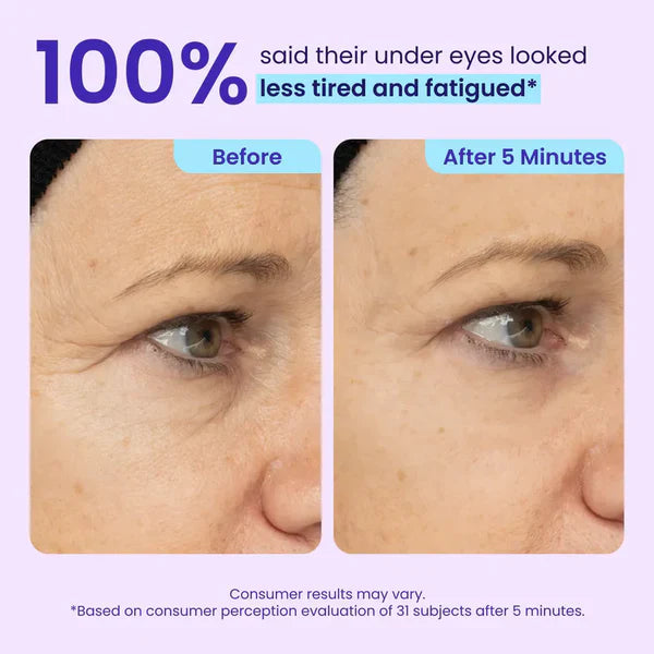 Wake Up Your Eyes – Look 10 Years Younger in 5 Minutes! 🌟