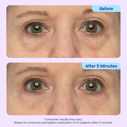 Wake Up Your Eyes – Look 10 Years Younger in 5 Minutes! 🌟