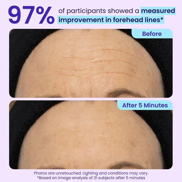Wake Up Your Eyes – Look 10 Years Younger in 5 Minutes! 🌟